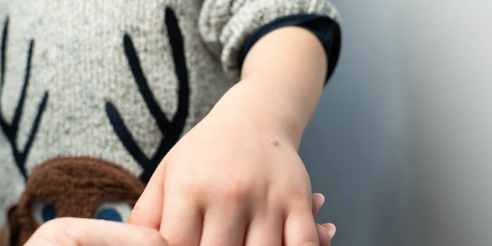 Kinderhand mit Warzen